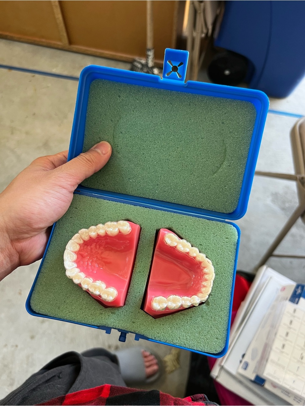 Invisalign Blue Case - Picture 2 of 2